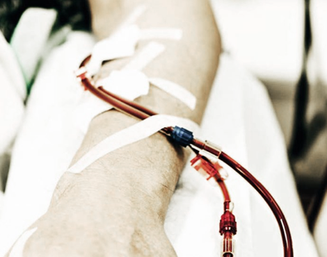 Arm van patiënt die hemodialyse in het ziekenhuis krijgt