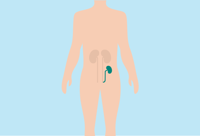 Wat is een niertransplantatie